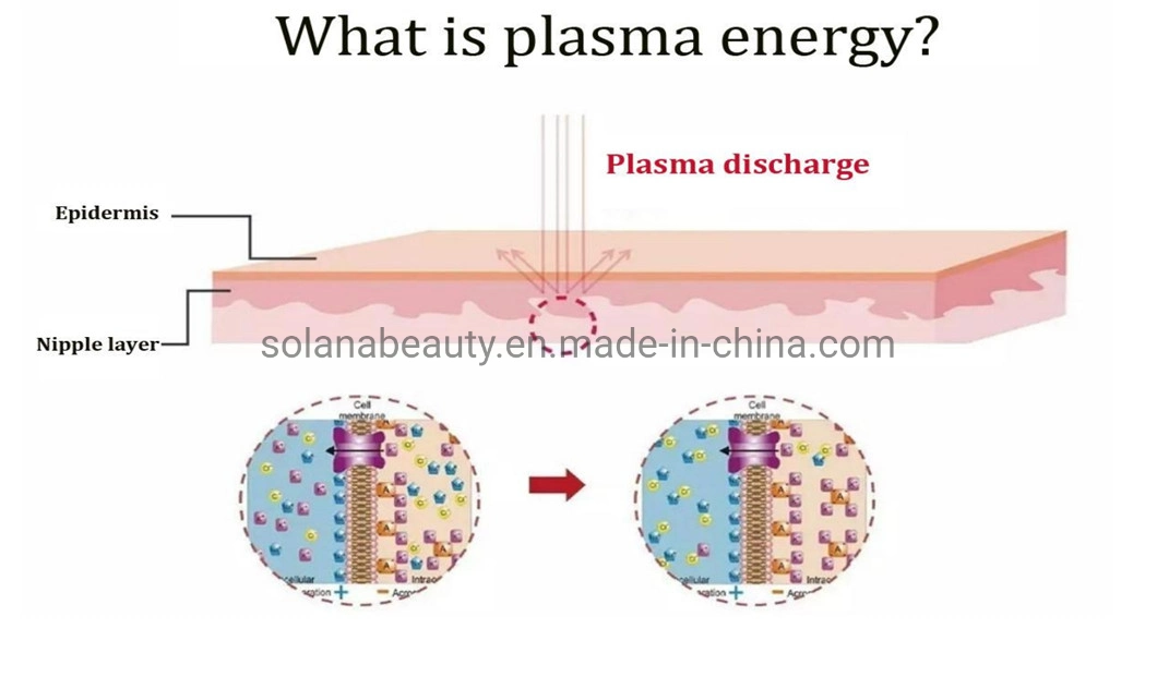 Professional Medical Plasma Pen for Eye Lift Scar Acne Removal Skin Tightening