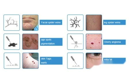 Ce système de thérapie des veines variqueuses polyvalentes Portable RF vasculaire Mole Removal Machine faciale galvanique à haute fréquence