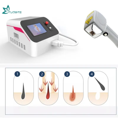 Le tatouage portatif de machine de laser de picoseconde enlèvent le dispositif commuté de peau de laser de carbone d'équipement